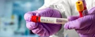 Офіційна інформація про кількість захворілих на COVID-19 в Україні та в Одеській області за минулу добу